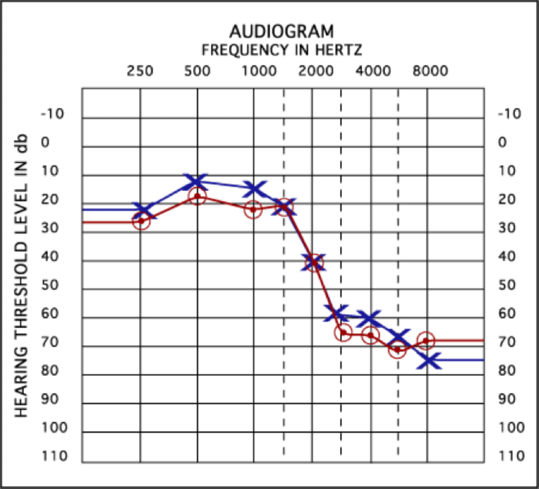 Hearing test chart